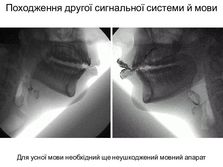 Походження другої сигнальної системи й мови Для усної мови необхідний ще неушкоджений мовний апарат