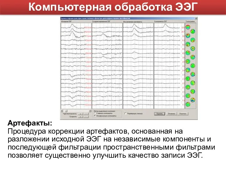 Артефакты: Процедура коррекции артефактов, основанная на разложении исходной ЭЭГ на независимые