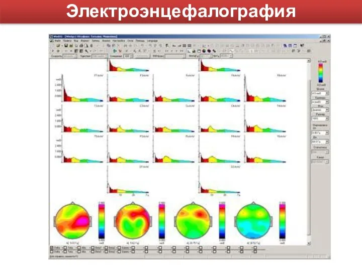 Электроэнцефалография