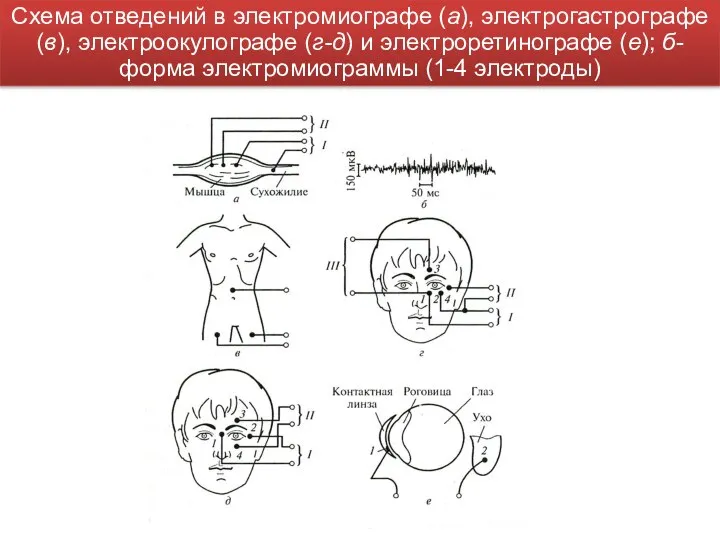 Схема отведений в электромиографе (а), электрогастрографе (в), электроокулографе (г-д) и электроретинографе