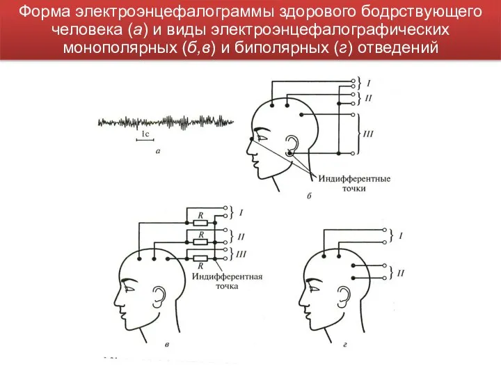 Форма электроэнцефалограммы здорового бодрствующего человека (а) и виды электроэнцефалографических монополярных (б,в) и биполярных (г) отведений