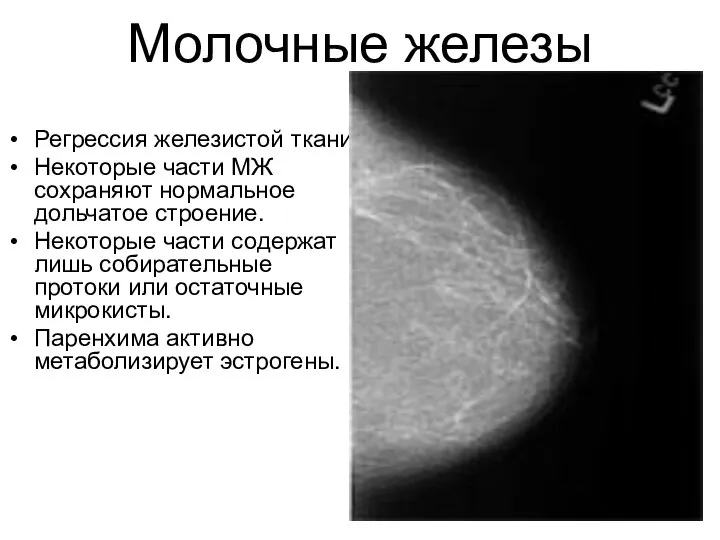 Молочные железы Регрессия железистой ткани. Некоторые части МЖ сохраняют нормальное дольчатое