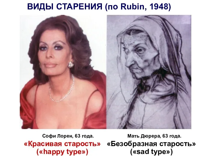 ВИДЫ СТАРЕНИЯ (по Rubin, 1948) «Безобразная старость» («sad type») «Красивая старость» («happy type»)