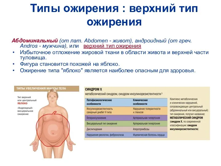 Типы ожирения : верхний тип ожирения Абдоминальный (от лат. Abdomen -