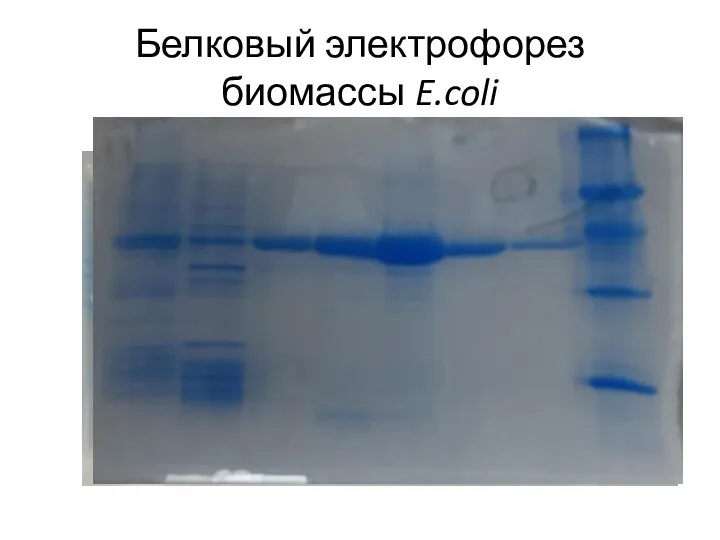 Белковый электрофорез биомассы E.coli