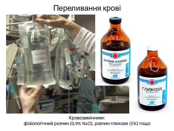 Переливання крові Кровозамінники: фізіологічний розчин (0,9% NaCl), розчин глюкози (5%) тощо