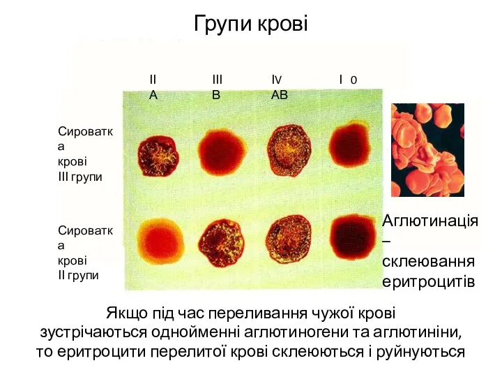 Групи крові Якщо під час переливання чужої крові зустрічаються однойменні аглютиногени