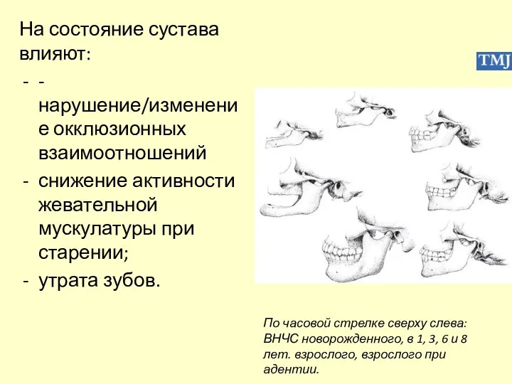 На состояние сустава влияют: -нарушение/изменение окклюзионных взаимоотношений снижение активности жевательной мускулатуры