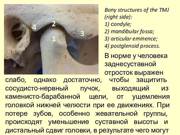 Bony structures of the TMJ (right side): 1) сondyle; 2) mandibular