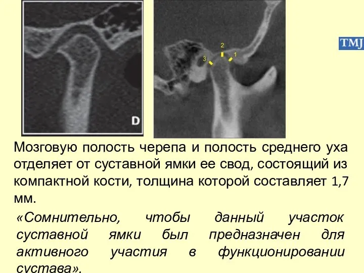 «Сомнительно, чтобы данный участок суставной ямки был предназначен для активного участия