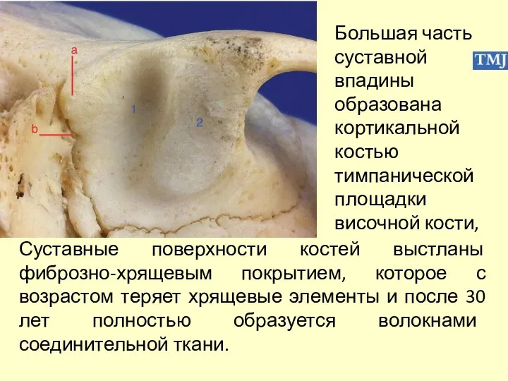 Большая часть суставной впадины образована кортикальной костью тимпанической площадки височной кости,