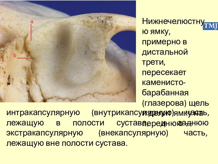 Нижнечелюстную ямку, примерно в дистальной трети, пересекает каменисто-барабанная (глазерова) щель и