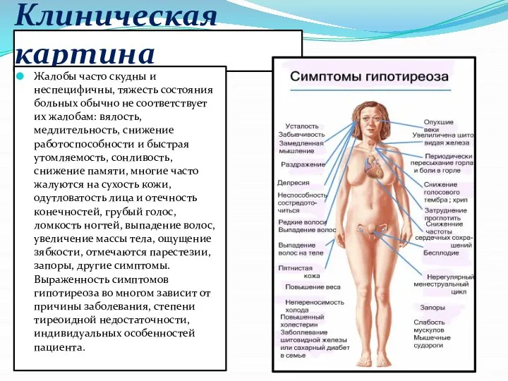 Клиническая картина Жалобы часто скудны и неспецифичны, тяжесть состояния больных обычно