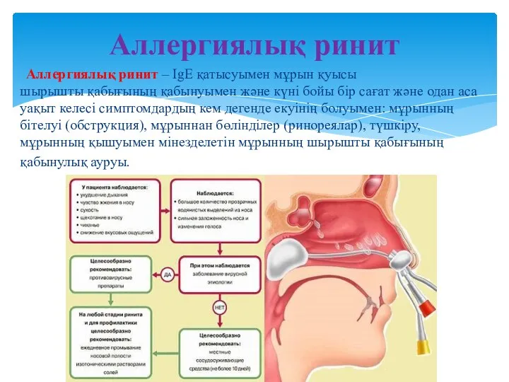 Аллергиялық ринит – IgE қатысуымен мұрын қуысы шырышты қабығының қабынуымен жəне