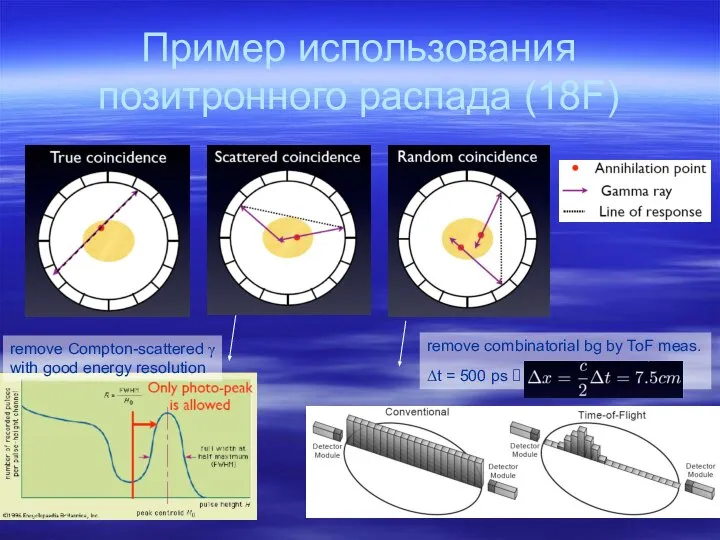 Пример использования позитронного распада (18F)‏ remove Compton-scattered γ with good energy