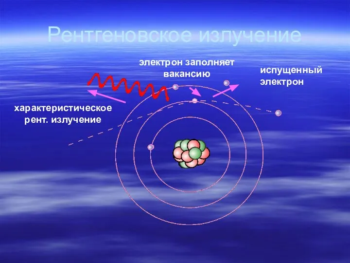 Рентгеновское излучение