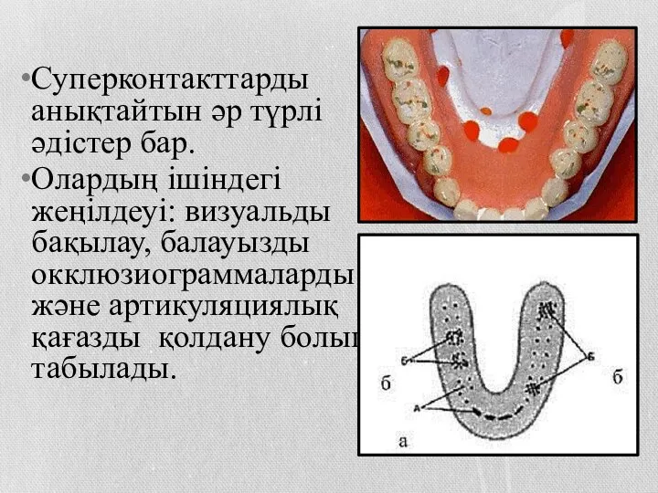 Суперконтакттарды анықтайтын әр түрлі әдістер бар. Олардың ішіндегі жеңілдеуі: визуальды бақылау,