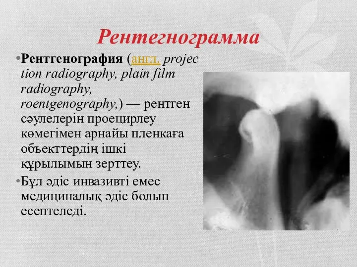 Рентегнограмма Рентгенография (англ. projection radiography, plain film radiography, roentgenography,) — рентген