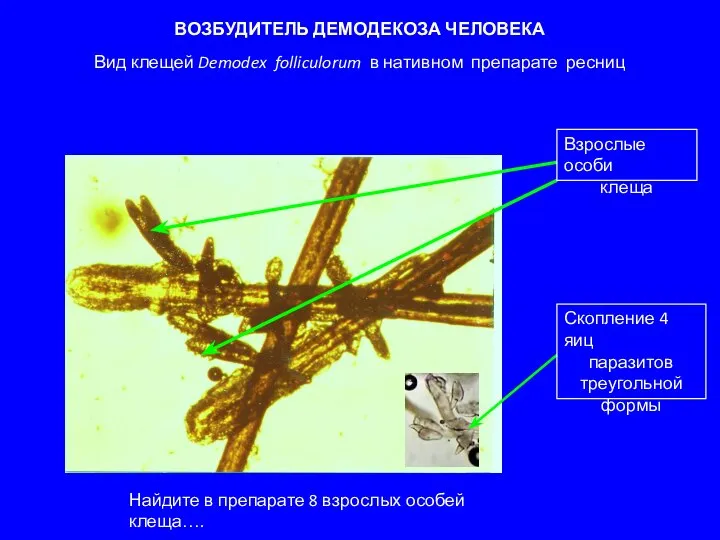 ВОЗБУДИТЕЛЬ ДЕМОДЕКОЗА ЧЕЛОВЕКА Вид клещей Demodex folliculorum в нативном препарате ресниц