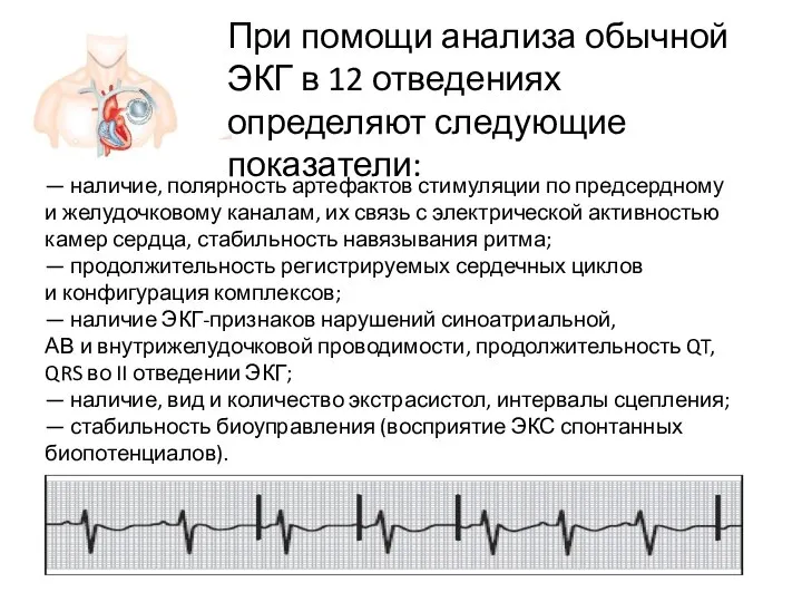 — наличие, полярность артефактов стимуляции по предсердному и желудочковому каналам, их