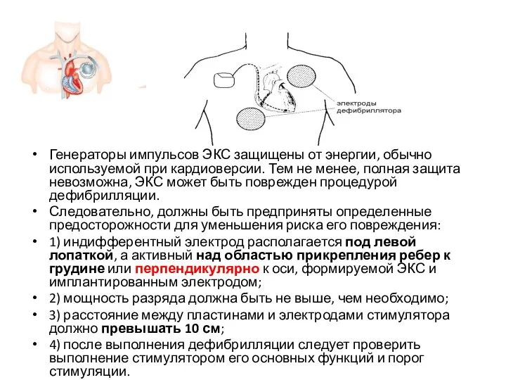 Генераторы импульсов ЭКС защищены от энергии, обычно используемой при кардиоверсии. Тем