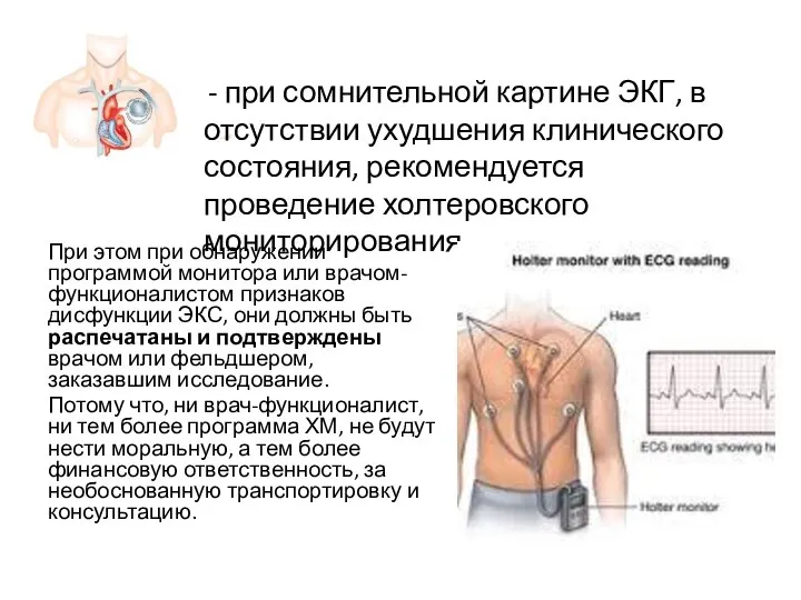 При этом при обнаружении программой монитора или врачом-функционалистом признаков дисфункции ЭКС,