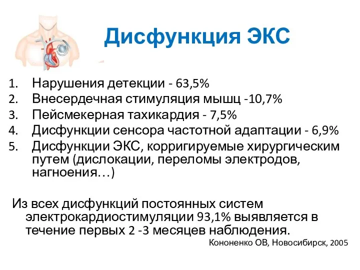 Дисфункция ЭКС Нарушения детекции - 63,5% Внесердечная стимуляция мышц -10,7% Пейсмекерная