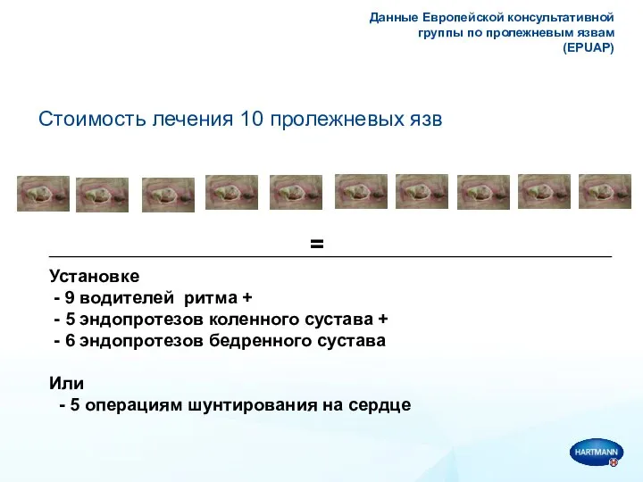 Данные Европейской консультативной группы по пролежневым язвам (EPUAP) Стоимость лечения 10