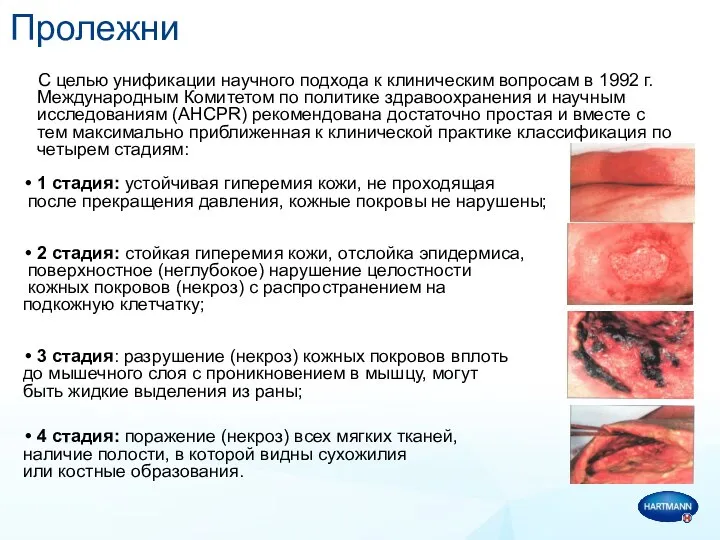 Пролежни С целью унификации научного подхода к клиническим вопросам в 1992