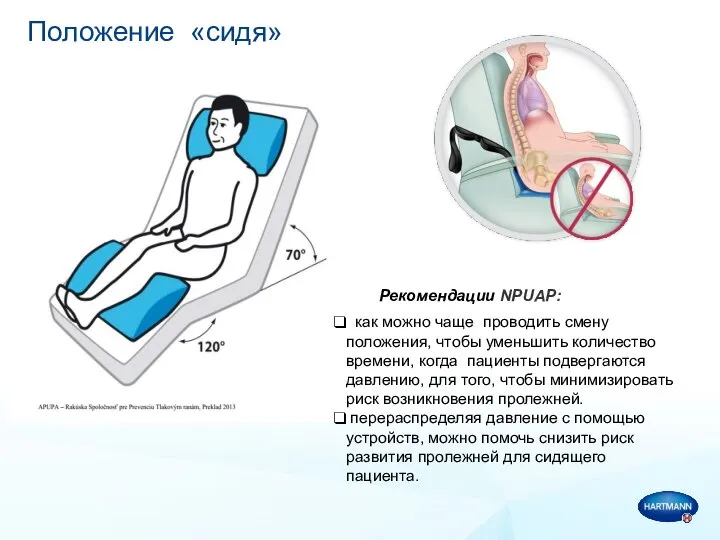 Положение «сидя» как можно чаще проводить смену положения, чтобы уменьшить количество