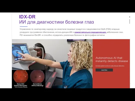 IDX-DR ИИ для диагностики болезни глаз Управление по санитарному надзору за