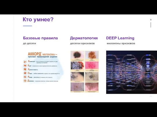 Кто умнее? DEEP Learning миллионы признаков Дерматология десятки признаков Базовые правила до десяти