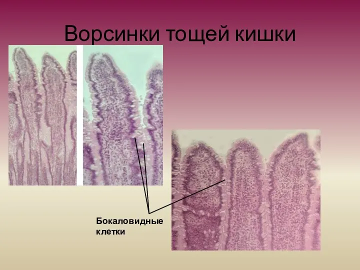 Ворсинки тощей кишки Бокаловидные клетки