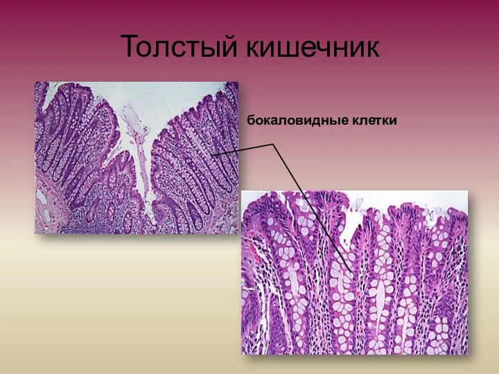 Толстый кишечник бокаловидные клетки