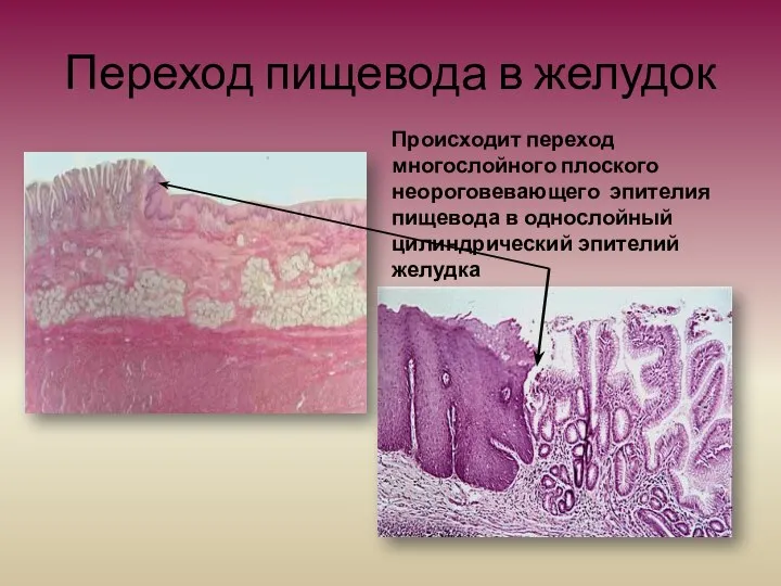 Переход пищевода в желудок Происходит переход многослойного плоского неороговевающего эпителия пищевода в однослойный цилиндрический эпителий желудка