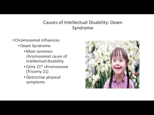 Causes of Intellectual Disability: Down Syndrome Chromosomal influences Down Syndrome Most