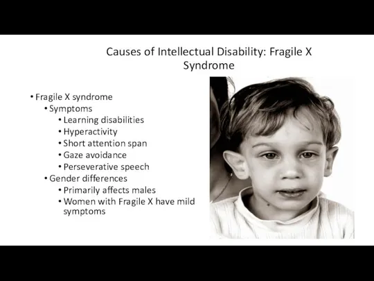 Causes of Intellectual Disability: Fragile X Syndrome Fragile X syndrome Symptoms