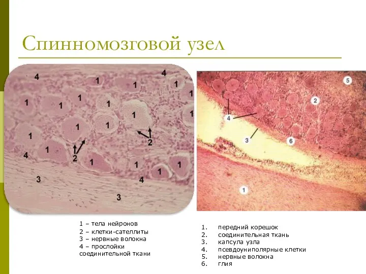 Спинномозговой узел 1 – тела нейронов 2 – клетки-сателлиты 3 –