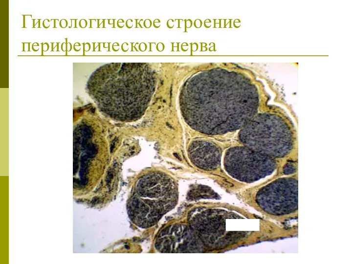 Гистологическое строение периферического нерва