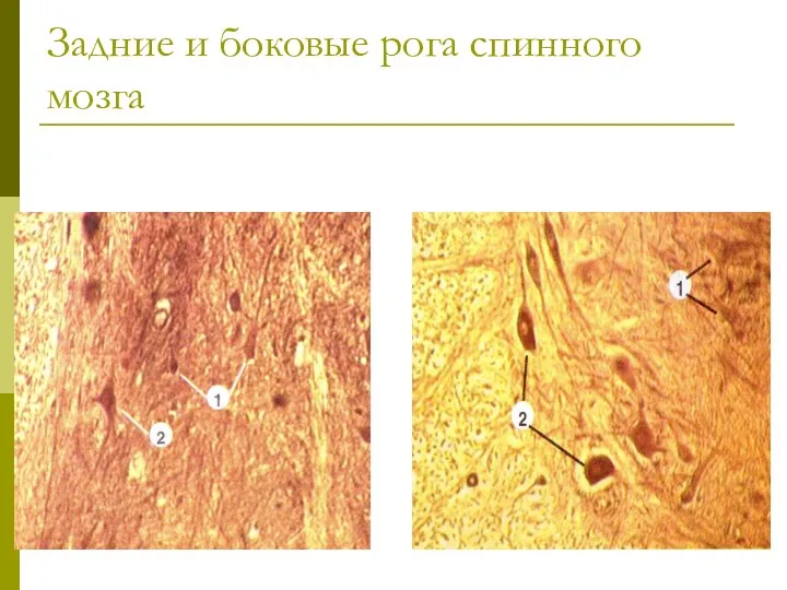 Задние и боковые рога спинного мозга