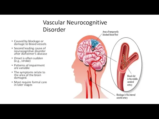 Vascular Neurocognitive Disorder Caused by blockage or damage to blood vessels