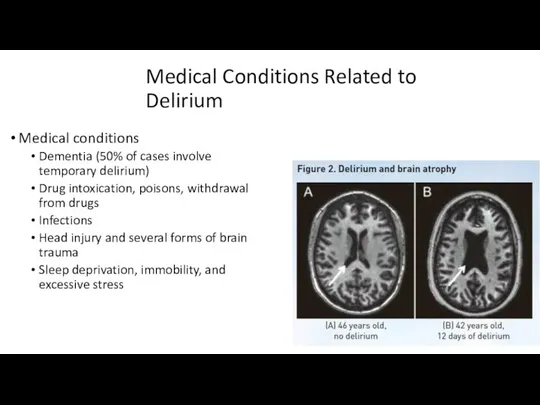 Medical Conditions Related to Delirium Medical conditions Dementia (50% of cases