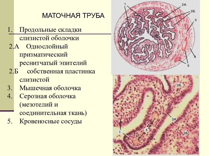 Продольные складки слизистой оболочки 2.А Однослойный призматический реснитчатый эпителий 2.Б собственная