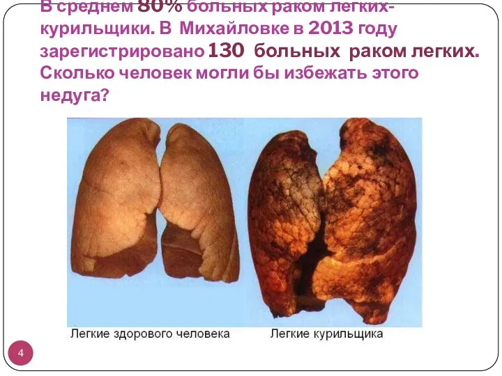 В среднем 80% больных раком легких- курильщики. В Михайловке в 2013