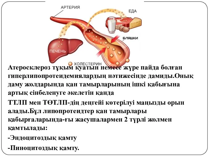 Атеросклероз тұқым қуатын немесе жүре пайда болған гиперлипопротеидемиялардың нәтижесінде дамиды.Онық даму