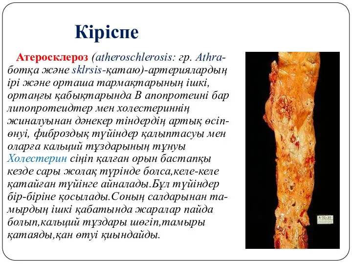 Кіріспе Атеросклероз (atheroschlerosis: гр. Athra-ботқа және sklrsis-қатаю)-артериялардың ірі және орташа тармақтарының