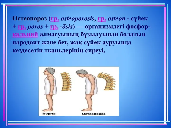 Остеопороз (гр. osteoporosis, гр. osteon - сүйек + гр. poros +