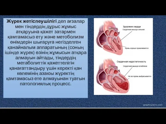 Жүрек жетіспеушілігі деп ағзалар мен тіндердің дұрыс жұмыс атқаруына қажет затармен