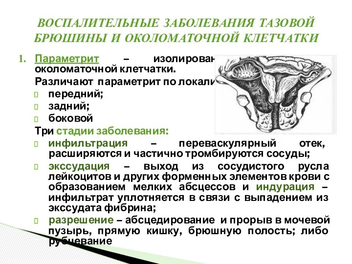 Параметрит – изолированное воспаление околоматочной клетчатки. Различают параметрит по локализации: передний;