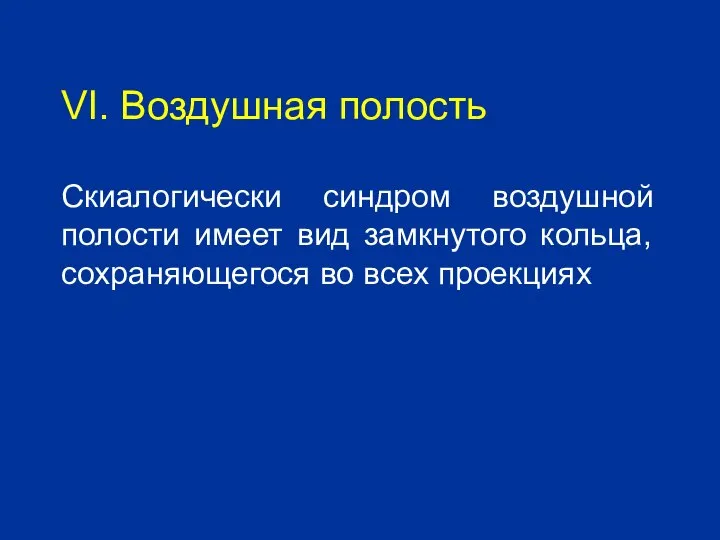 VI. Воздушная полость Скиалогически синдром воздушной полости имеет вид замкнутого кольца, сохраняющегося во всех проекциях